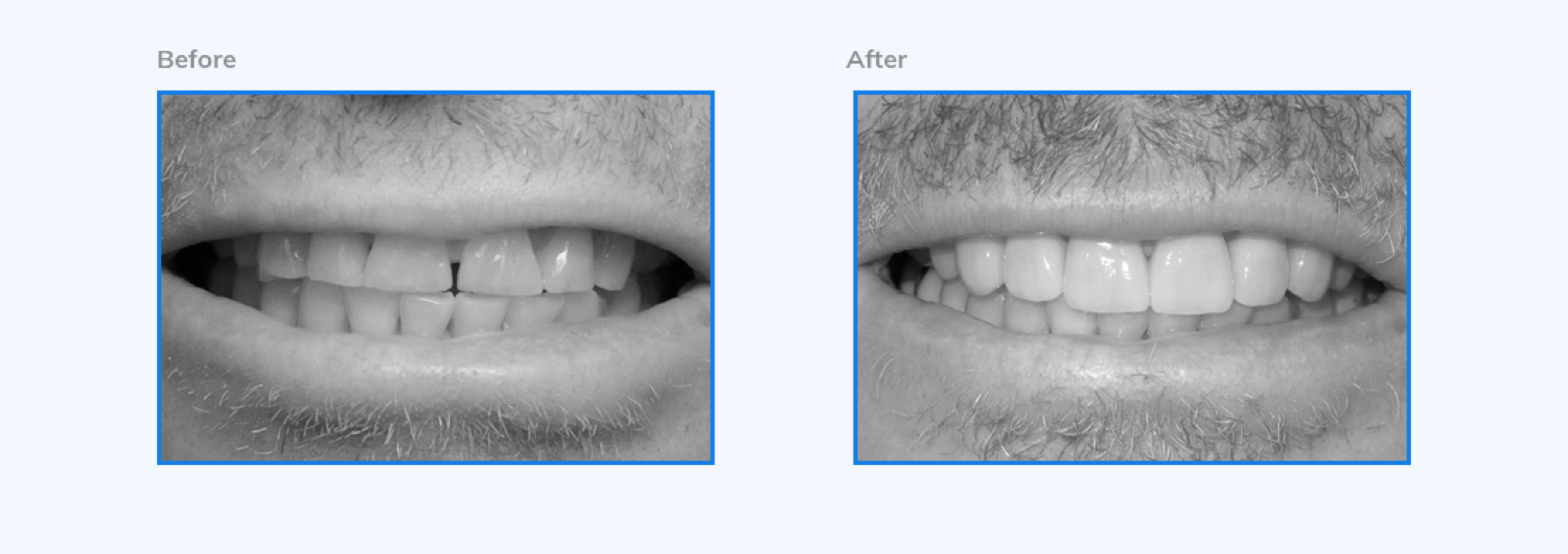 Galería dental - Implantes y tratamientos